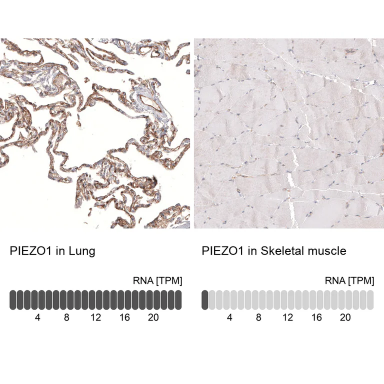 Immunohistochemistry (Formalin/PFA-fixed paraffin-embedded sections) - Anti-PIEZO1 Antibody [CL9714] (AB327129)