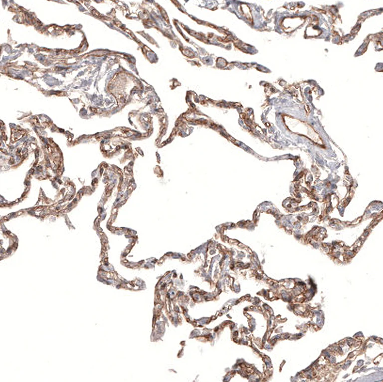 Immunohistochemistry (Formalin/PFA-fixed paraffin-embedded sections) - Anti-PIEZO1 Antibody [CL9714] (AB327129)
