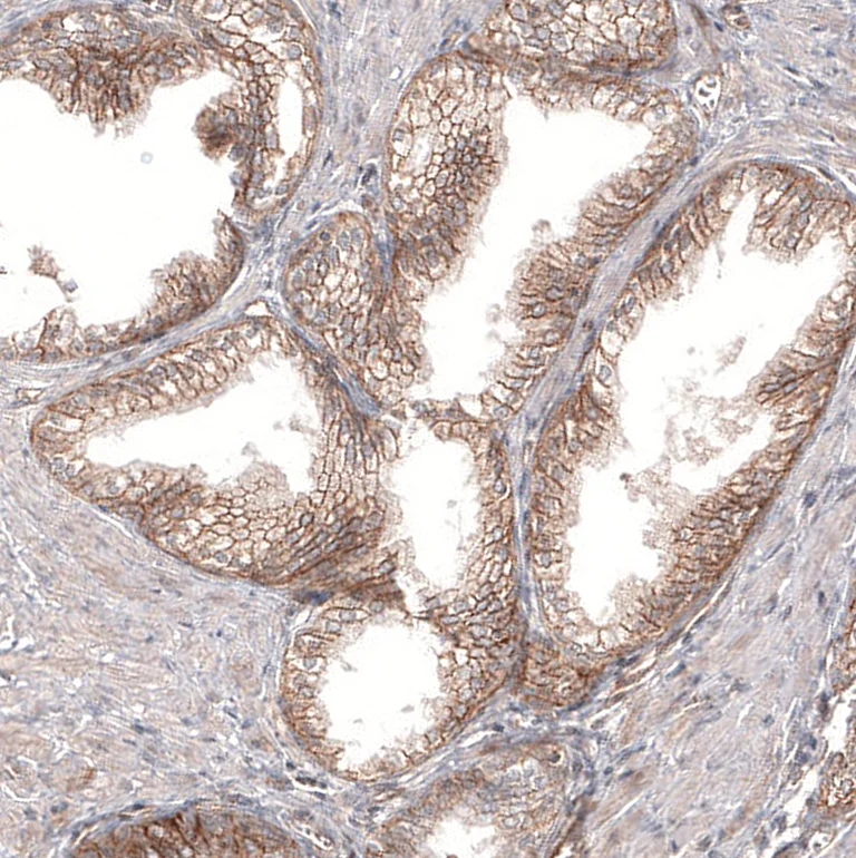 Immunohistochemistry (Formalin/PFA-fixed paraffin-embedded sections) - Anti-PIEZO1 Antibody [CL9714] (AB327129)