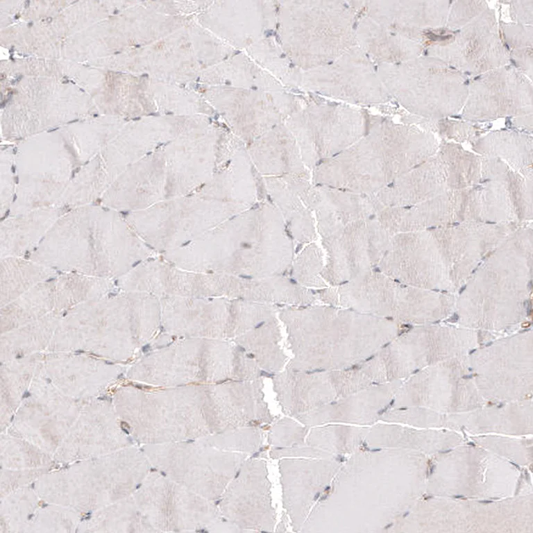 Immunohistochemistry (Formalin/PFA-fixed paraffin-embedded sections) - Anti-PIEZO1 Antibody [CL9714] (AB327129)