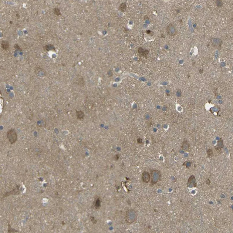 Immunohistochemistry (Formalin/PFA-fixed paraffin-embedded sections) - Anti-PIEZO2 antibody (AB244349)