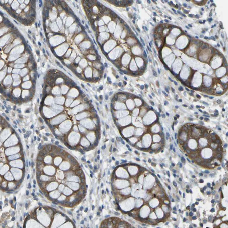 Immunohistochemistry (Formalin/PFA-fixed paraffin-embedded sections) - Anti-PIEZO2 antibody (AB244349)