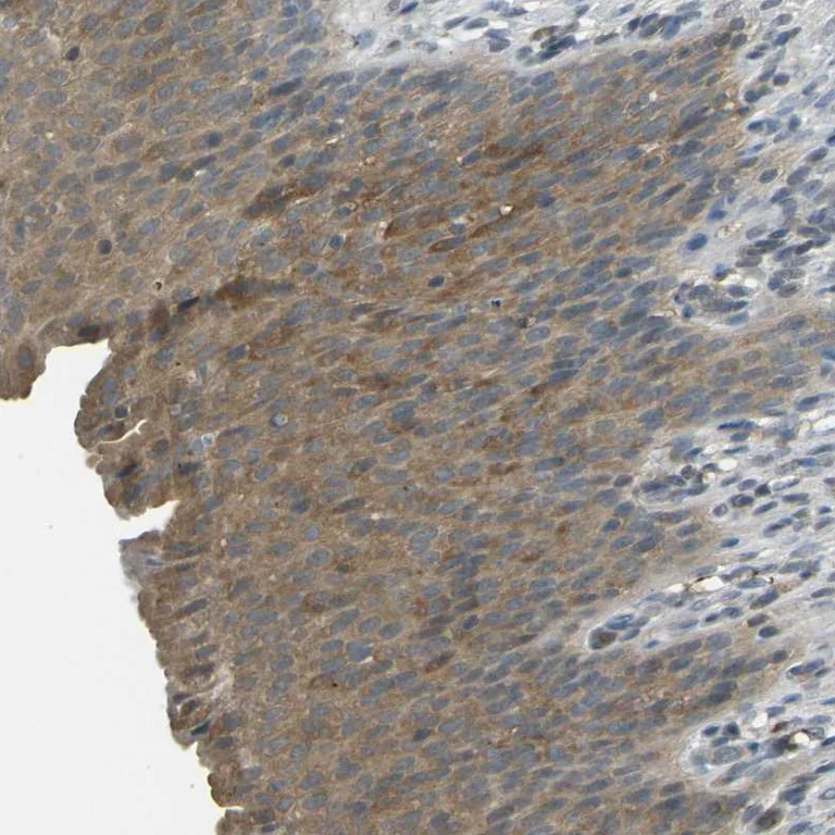 Immunohistochemistry (Formalin/PFA-fixed paraffin-embedded sections) - Anti-PIEZO2 antibody (AB244349)