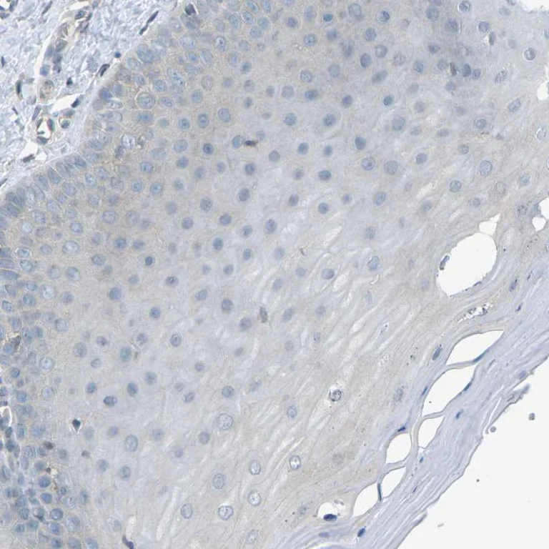 Immunohistochemistry (Formalin/PFA-fixed paraffin-embedded sections) - Anti-PIEZO2 antibody (AB244349)