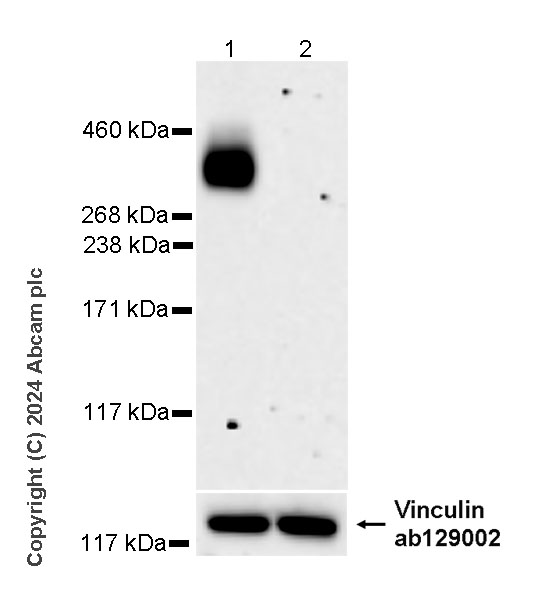 Western blot - Anti-PIEZO2 antibody [EPR27152-48] - BSA and Azide free (AB318188), expandable thumbnail