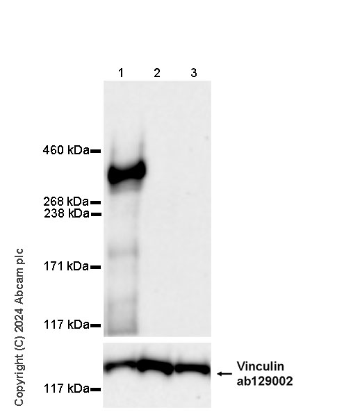 Western blot - Anti-PIEZO2 antibody [EPR27152-48] - BSA and Azide free (AB318188), expandable thumbnail