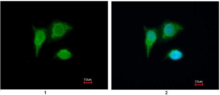 Immunocytochemistry/ Immunofluorescence - Anti-PIG3 antibody (AB96819), expandable thumbnail