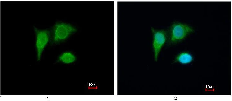 Immunocytochemistry/ Immunofluorescence - Anti-PIG3 antibody (AB96819)