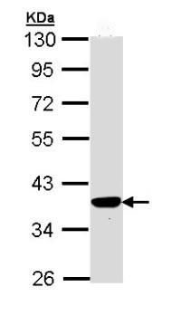Western blot - Anti-PIG3 antibody (AB96819), expandable thumbnail