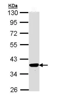 Western blot - Anti-PIG3 antibody (AB96819)