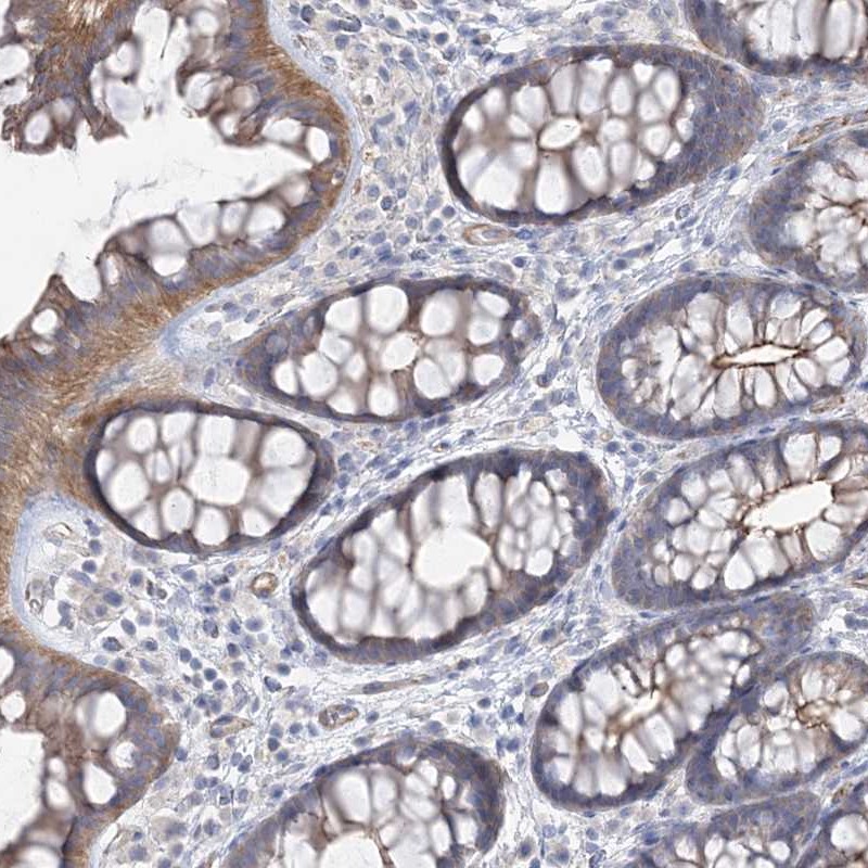 Immunohistochemistry (Formalin/PFA-fixed paraffin-embedded sections) - Anti-PIGC antibody (AB272617)