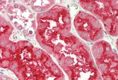 Immunohistochemistry (Formalin/PFA-fixed paraffin-embedded sections) - Anti-PiGF antibody - C-terminal (AB230516)