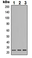 Western blot - Anti-PiGF antibody - C-terminal (AB230516)