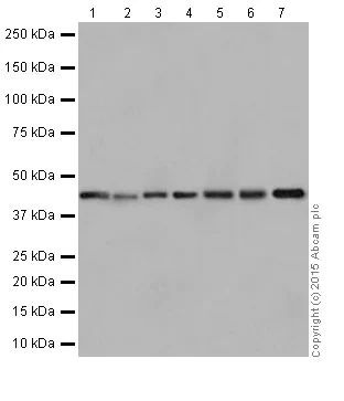 Western blot - Anti-PIGK antibody [EPR17843] - BSA and Azide free (AB251354)