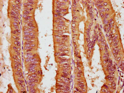 Immunohistochemistry (Formalin/PFA-fixed paraffin-embedded sections) - Anti-PIGN antibody (AB238577)