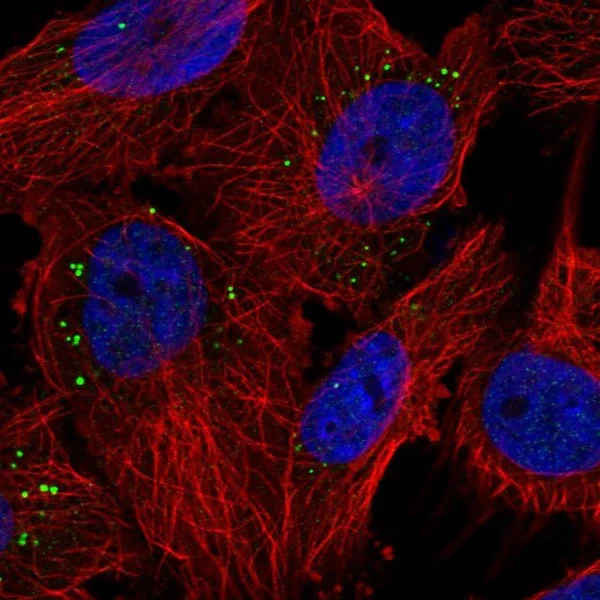 Immunocytochemistry/ Immunofluorescence - Anti-PIGP antibody (AB224128)
