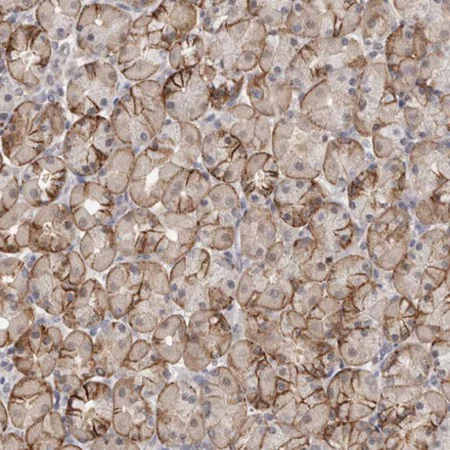 Immunohistochemistry (Formalin/PFA-fixed paraffin-embedded sections) - Anti-PIGP antibody (AB224128)