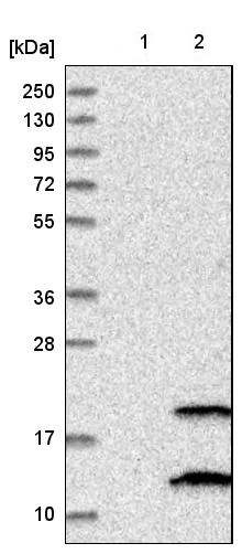 Western blot - Anti-PIGP antibody (AB224128)