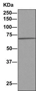 Immunoprecipitation - Anti-PIGS antibody [EPR11275(B)] (AB157211)