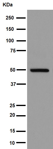 Western blot - Anti-Pigu antibody [EPR16424] - C-terminal (AB192255), expandable thumbnail