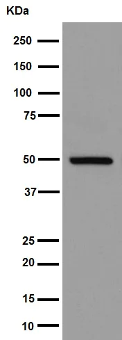 Western blot - Anti-Pigu antibody [EPR16424] - C-terminal (AB192255)