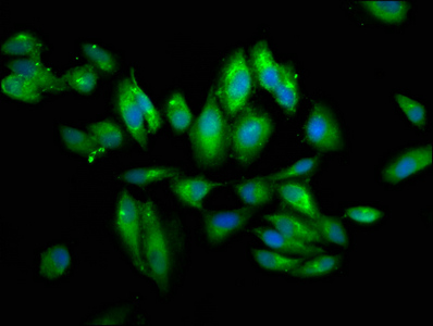 Immunocytochemistry/ Immunofluorescence - Anti-PIGV antibody (AB237692)