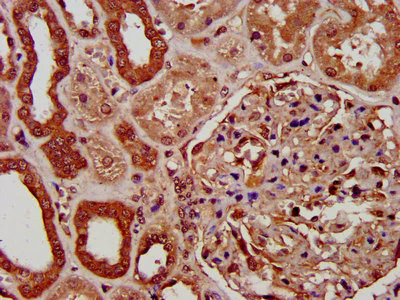 Immunohistochemistry (Formalin/PFA-fixed paraffin-embedded sections) - Anti-PIGV antibody (AB237692)