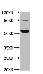 Western blot - Anti-PIGV antibody (AB237692)