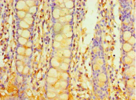 Immunohistochemistry (Formalin/PFA-fixed paraffin-embedded sections) - Anti-PIGX antibody (AB235338)