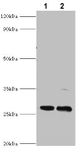 Western blot - Anti-PIGX antibody (AB235338)