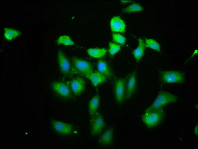 Immunocytochemistry/ Immunofluorescence - Anti-PIH1D1 antibody (AB238862)
