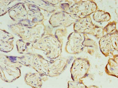 Immunohistochemistry (Formalin/PFA-fixed paraffin-embedded sections) - Anti-PIH1D1 antibody (AB238862)