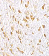 Immunohistochemistry (Formalin/PFA-fixed paraffin-embedded sections) - Anti-PIKE antibody (AB21271)