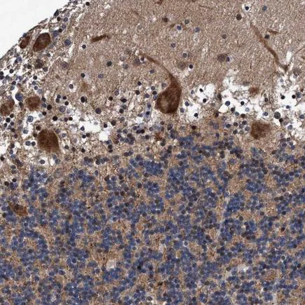 Immunohistochemistry (Formalin/PFA-fixed paraffin-embedded sections) - Anti-PIKE antibody (AB224118)