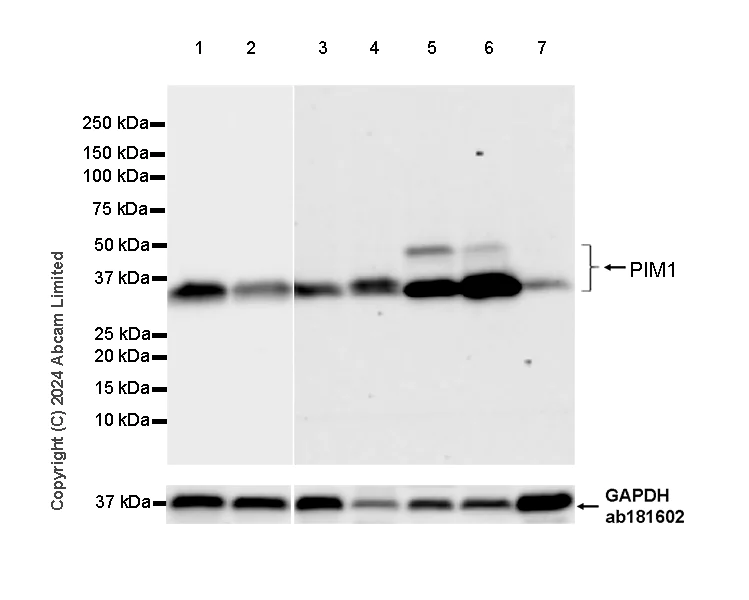 Western blot - Anti-PIM1 antibody [EPR28184-93] - BSA and Azide free (AB324767)