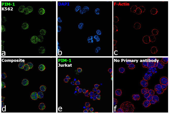 Immunocytochemistry/ Immunofluorescence - Anti-PIM1 antibody [RP23040089] (AB308006)