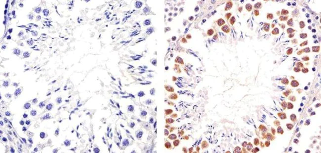 Immunohistochemistry (Formalin/PFA-fixed paraffin-embedded sections) - Anti-PIM1 antibody [RP23040089] (AB308006)
