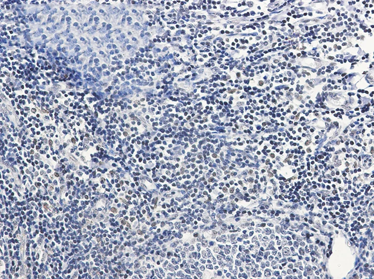 Immunohistochemistry (Formalin/PFA-fixed paraffin-embedded sections) - Anti-PIM1 Antibody [S08-8D5] (AB317411)