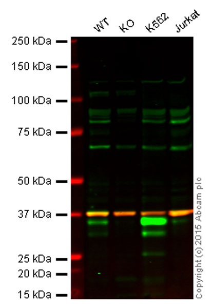 Western blot - Anti-PIM1 antibody [ZP003] (AB54503), expandable thumbnail