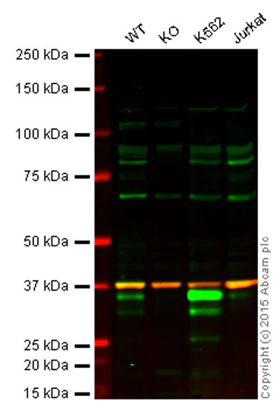 Western blot - Anti-PIM1 antibody [ZP003] (AB54503)