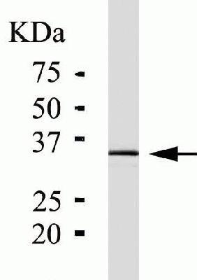Western blot - Anti-PIM1 antibody [ZP003] (AB54503), expandable thumbnail