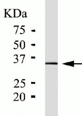Western blot - Anti-PIM1 antibody [ZP003] (AB54503)