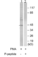 Western blot - Anti-PIM1 (phospho Y309) antibody (AB74047)