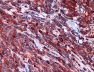 Immunohistochemistry (Formalin/PFA-fixed paraffin-embedded sections) - Anti-PIM2 antibody (AB93667), expandable thumbnail