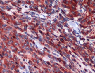 Immunohistochemistry (Formalin/PFA-fixed paraffin-embedded sections) - Anti-PIM2 antibody (AB93667)