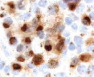 Immunohistochemistry (Formalin/PFA-fixed paraffin-embedded sections) - Anti-PIM2 antibody [CHU61B] (AB107102)