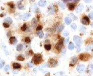 Immunohistochemistry (Formalin/PFA-fixed paraffin-embedded sections) - Anti-PIM2 antibody [CHU61B] (AB107102)