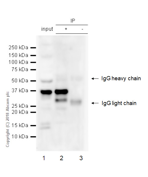 Immunoprecipitation - Anti-PIM2 antibody [EPR6987] (AB129057), expandable thumbnail