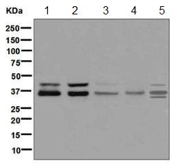 Western blot - Anti-PIM2 antibody [EPR6987] (AB129057), expandable thumbnail