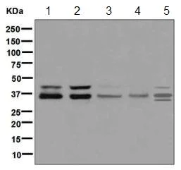Western blot - Anti-PIM2 antibody [EPR6987] (AB129057)